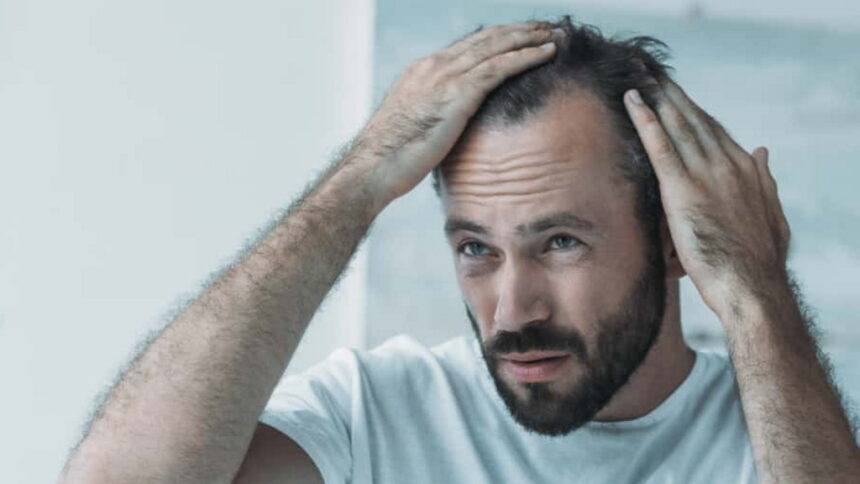 कम उम्र में बाल अधिक झड़ना या सफेद होना है इन 4 गंभीर बीमारियों का संकेत